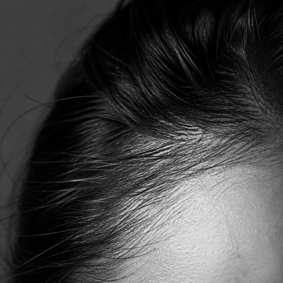Dry Scalp and Hairfall